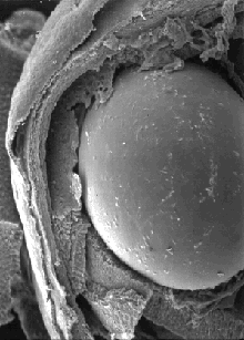 [صورة: eye017-1b.gif]