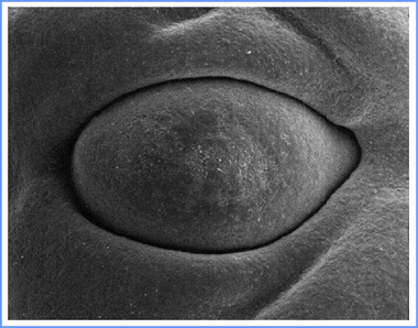 [صورة: eye025b.gif]