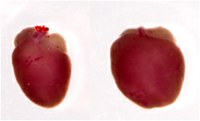 Hearts from a wild type control mouse (left) and from a DOT1L-deleted mouse displaying dilated cardiomyopathy (right) . In the absence of DOT1L hearts become severely enlarged, compromising heart function.