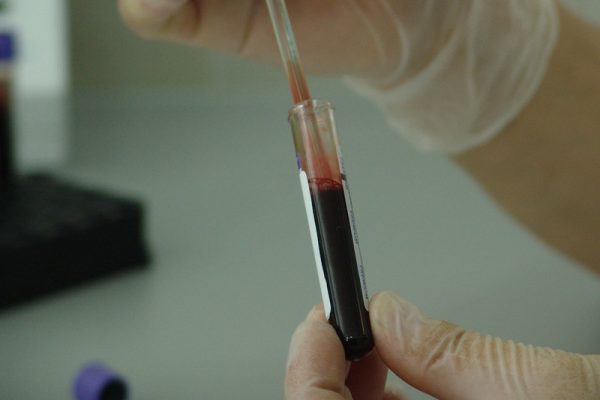 HIV test tube of blood image