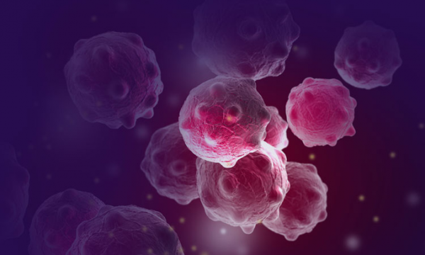 breast cancer cells image