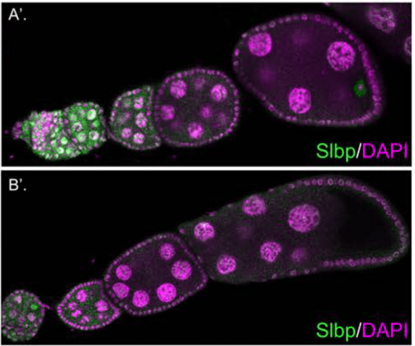 scientific image: (green; DNA in magenta) in Drosophila egg chambers of wild-type (top) and SLBP mutant (bottom) (click to enlarge; see article for details)