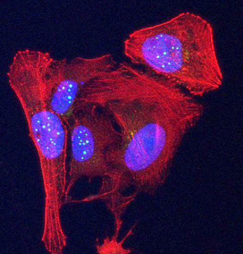 Cell with telomere protein stained.