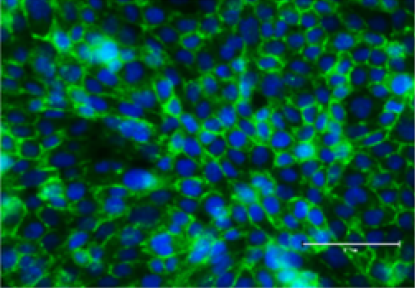Microglia isolated from ART-suppressed, SIV-infected rhesus macaques. Blue and green cells