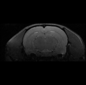 3D Rat Brain T2-weighted MRI