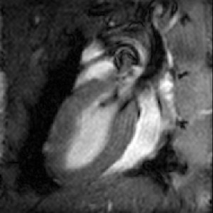 2D mouse T1-Weighted Cardiac CINE