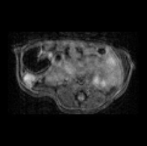 Mouse Abdomen Anatomical MRI