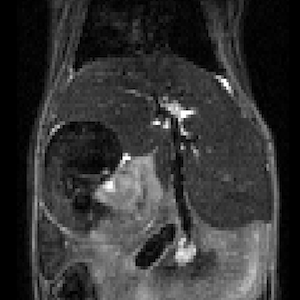 Mouse Abdomen Anatomical MRI
