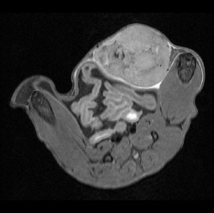 Mouse Tumor Anatomical MRI