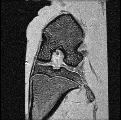 Rat Knee Anatomical MRI