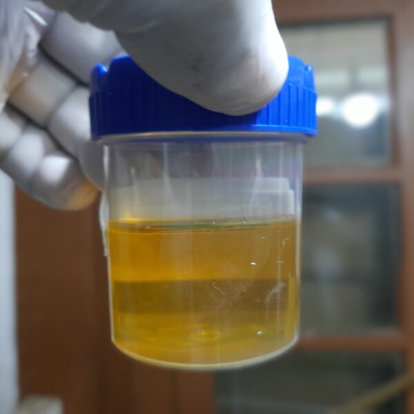 gloved hand with urine specimen