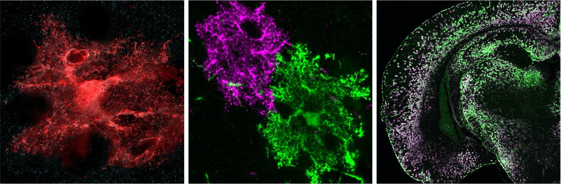 Different examples of astrocytes in the mouse brain with fluorescent labeling