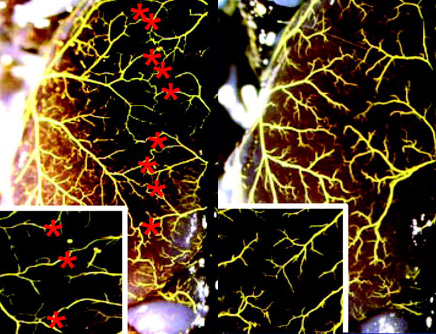 Figure 1. Phenotypes of the native cerebral cortical pial collateral circulation
