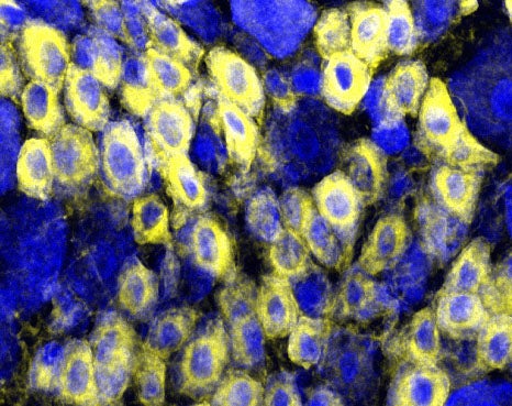 Prostatic acid phosphatase (PAP) on pain-sensing neurons