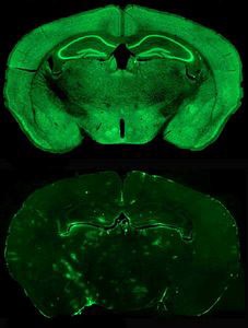 At top, a mouse brain showing flourescent expression of the UBE3A gene, and below, lack of expression when the maternal copy of the gene is missing.