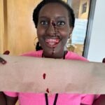 A close-up picture of Eithar's "broken nose".