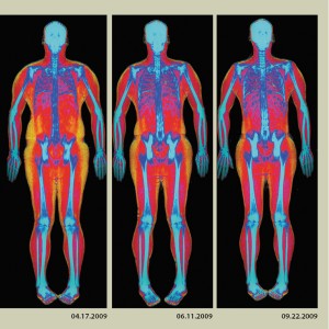 DEXA body composition scan to determine and display different tissue types.