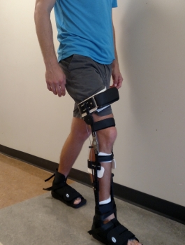 Applying stance phase knee control during gait for people with stroke undergoing inpatient rehabilitation.