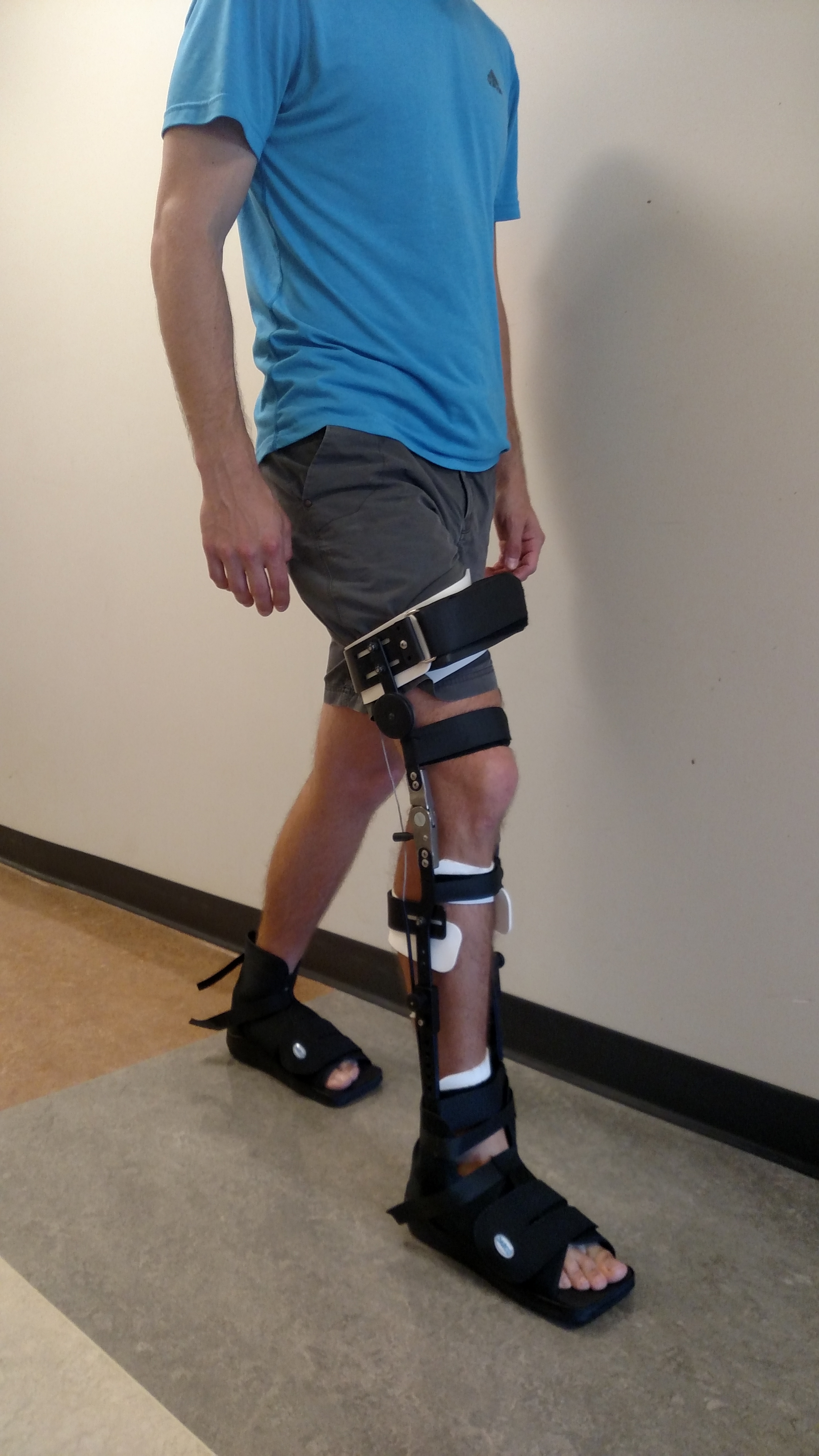 Applying stance phase knee control during gait for people with stroke undergoing inpatient rehabilitation.