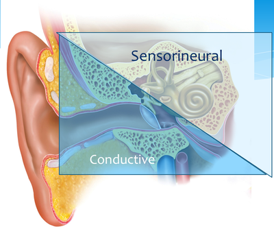 ear diagram