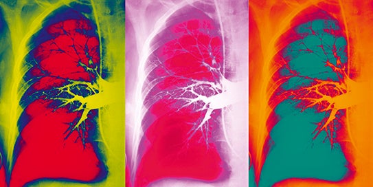 Three-panel decorative image of a false-color lung x-ray