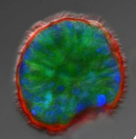 Human primary nasal cells grown as 3D sphere cultures. 