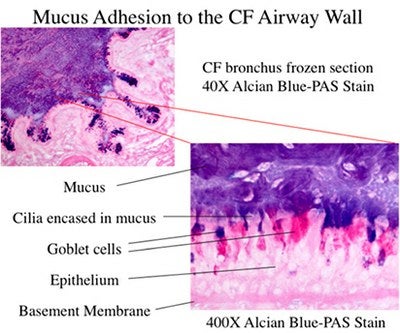 Images of a frozen section of a human cystic fibrosis airway