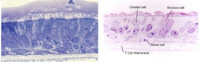 Microscopy images of human bronchial epithelial cells in culture