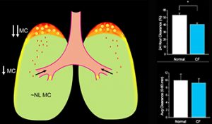 CF Produces Heterogeneous Structural and ‘Basal’ Mucus Clearance Lung Defects