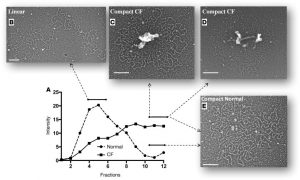 Transmission electron micrographs of mucin conformation reveal a defective MUC5B unpacking process in CF