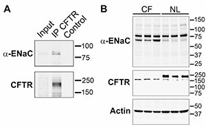 Figure 3. A. α-ENaC co-immunoprecipitates with CFTR in primary airway cells (HAE)