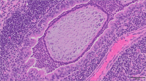 Confocal microscopy image of a histological section of a bacteria-laden alginate bead in the airway of a mouse infected with Pseudomonas aeruginosa 