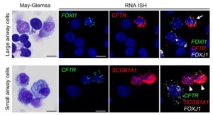 CFTR expression in freshly excised normal human large and small airway epithelial cells by RNA-ISH