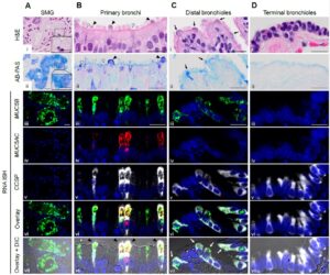MUC5AC, MUC5B, and CCSP mRNA co-expression is region-specific in normal human airways