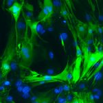 These cardiomyocytes (green with blue nuclei) had been fibroblasts before Frank Conlon's UNC lab reprogrammed them.