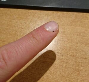 Seed Tick on an index finger.