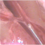 Image of surgery model a femoral artery injury