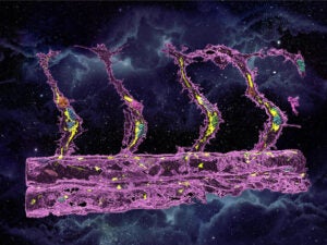 Vascular Cell Biology Gordon Research Seminar