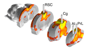 fMRI and optical fiber photometry (IMAGE)