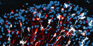 Cerebellar mossy fibers and granule cells