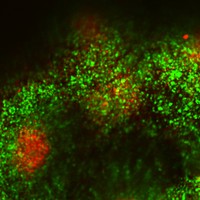 the interaction between effector T cells (green) and regulatory T cells (red) in a specialized immune structure called Peyer’s patch in the intestine of a mouse.