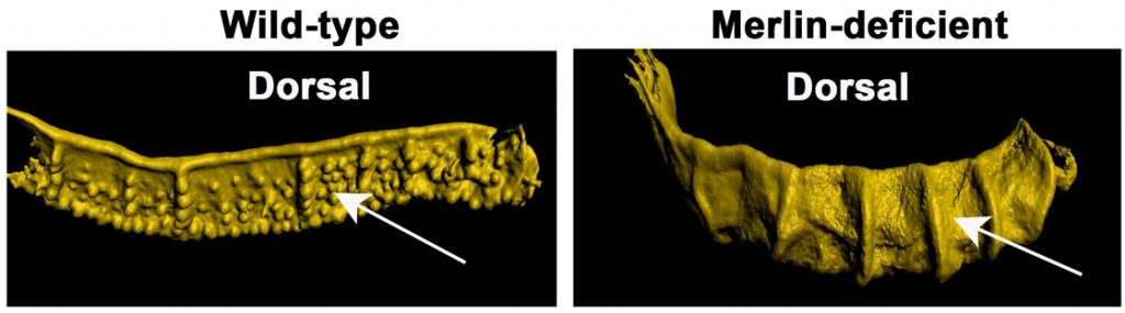 3D imaging of total endometrial epithelium from wild-type and Merlin-deficient endometrium