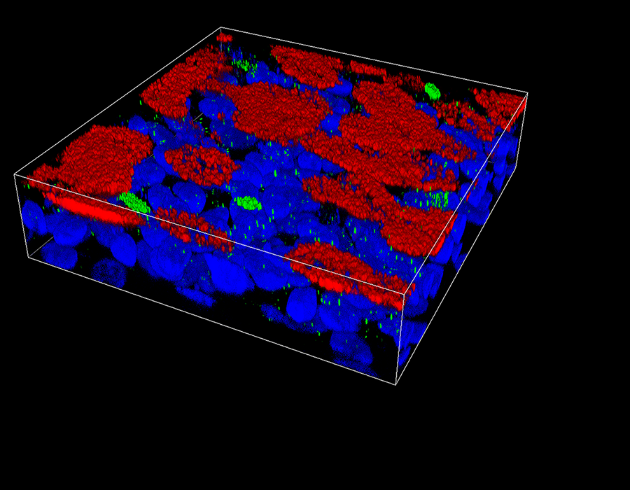 3D image stack of primary bronchial epithelial cells showing CFTR (green), cillia (red) and nuclei (blue)