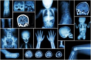 Pediatric Radiology Images