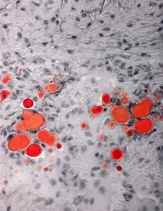 Gray cells with darker gray spots interspersed with groups of larger orange spots.