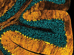 Close up of part of a CHIP knockout mouse cerebellum showing folded loops of gold colored Calbindin next to a cyan colored methyl green counterstain.