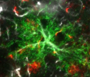 green colored astrocytes in the brain of a mouse