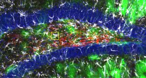 Blue neural stem cells, red Cholecystokinin interneurons , and astroycytes in the dental gyrus in the brain of adult mouse.