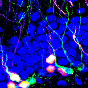Song Lab: Adult born neurons
