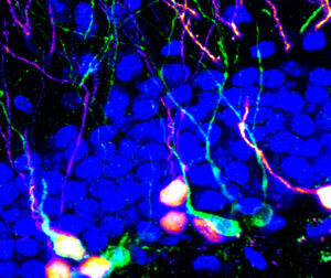 Song Lab: Adult born neurons